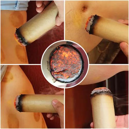 灸溫，到底是燙的好還是溫的好？為什么有的人感覺(jué)不到熱?