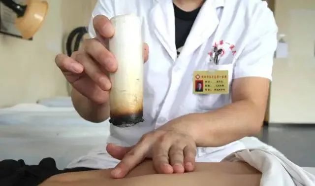 產后艾灸一個月，十年少生病！ 